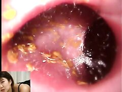 KOR DWB 03 (pt 1) KOR DWB 03 (pt 1)