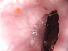 KOR DWA 10 KOR DWA 10